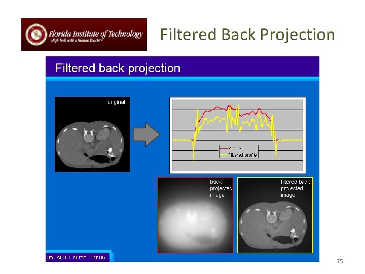 Filtered Back Projection 75 