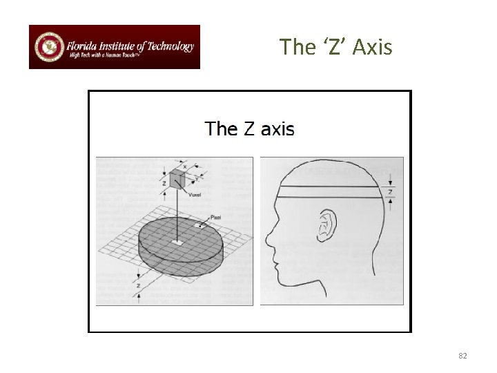 The ‘Z’ Axis 82 