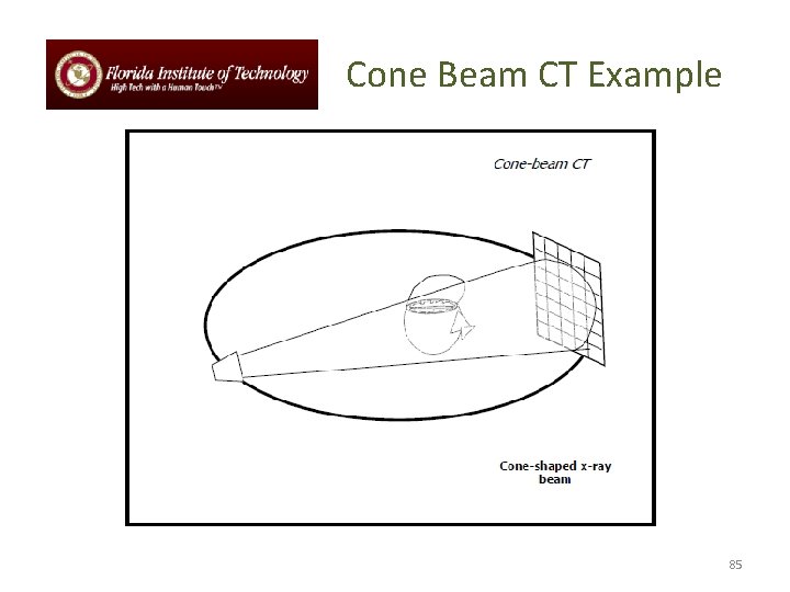 Cone Beam CT Example 85 