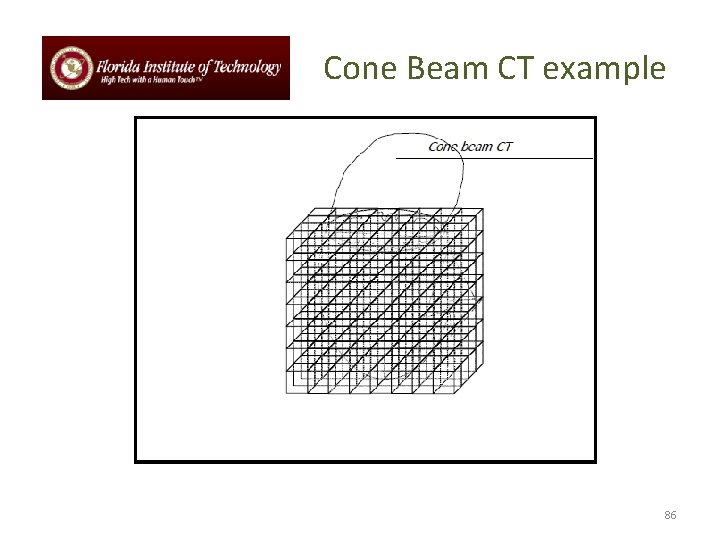 Cone Beam CT example 86 