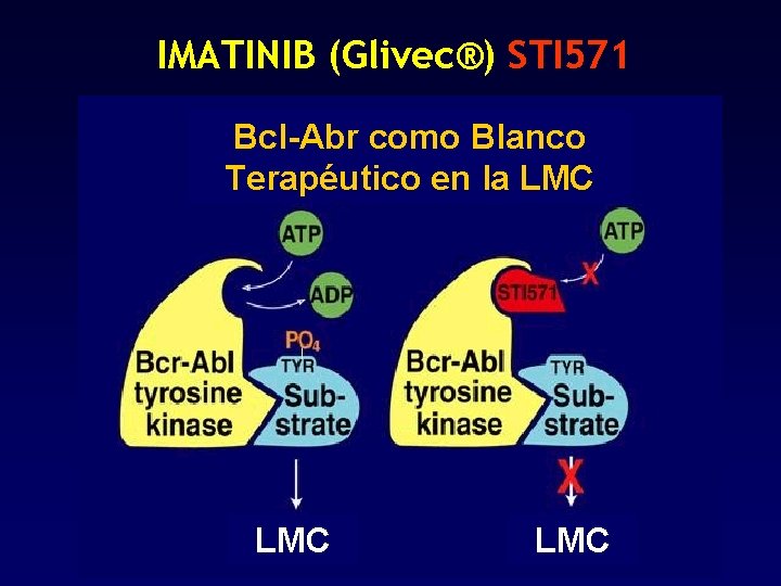 IMATINIB (Glivec®) STI 571 Bcl-Abr como Blanco Terapéutico en la LMC LMC IMATINIB (Glivec®) STI 571 Bcl-Abr como Blanco Terapéutico en la LMC LMC