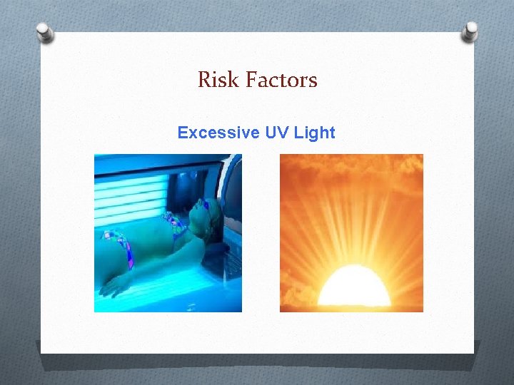 Risk Factors Excessive UV Light Risk Factors Excessive UV Light