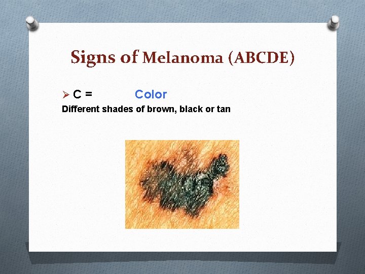 Signs of Melanoma (ABCDE) ØC = Color Different shades of brown, black or tan Signs of Melanoma (ABCDE) ØC = Color Different shades of brown, black or tan