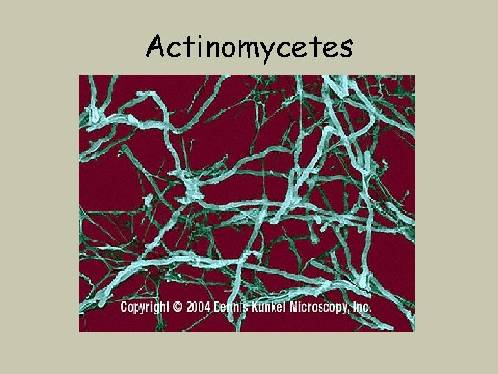 Actinomycetes 