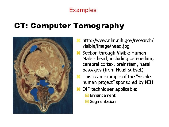 Examples CT: Computer Tomography z http: //www. nlm. nih. gov/research/ visible/image/head. jpg z Section