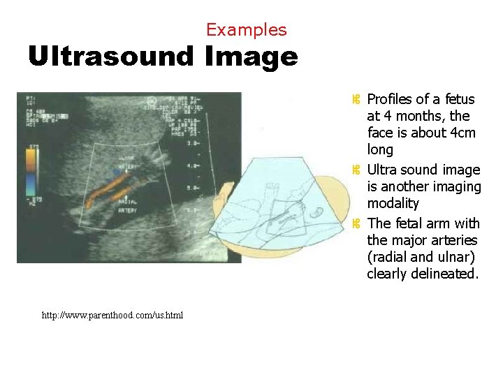 Examples Ultrasound Image z Profiles of a fetus at 4 months, the face is