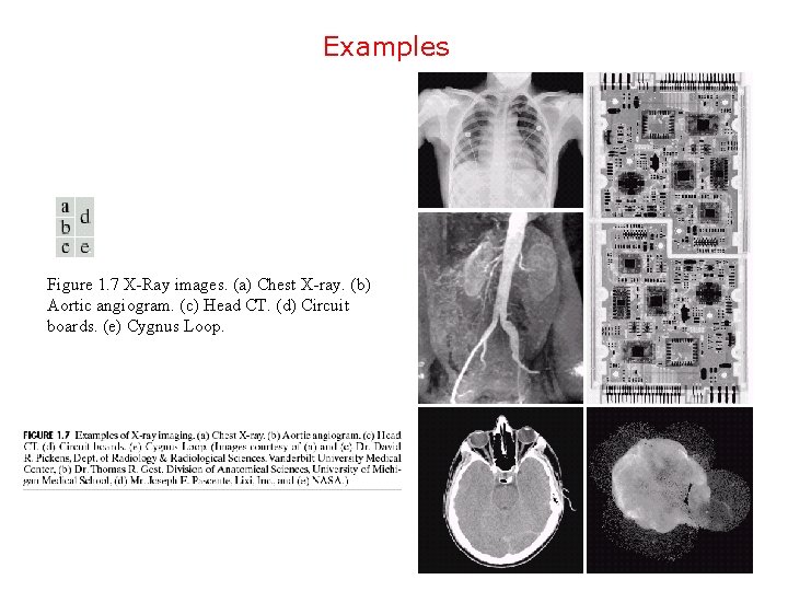 Examples Figure 1. 7 X-Ray images. (a) Chest X-ray. (b) Aortic angiogram. (c) Head