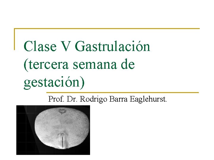 Clase V Gastrulación (tercera semana de gestación) Prof. Dr. Rodrigo Barra Eaglehurst. 