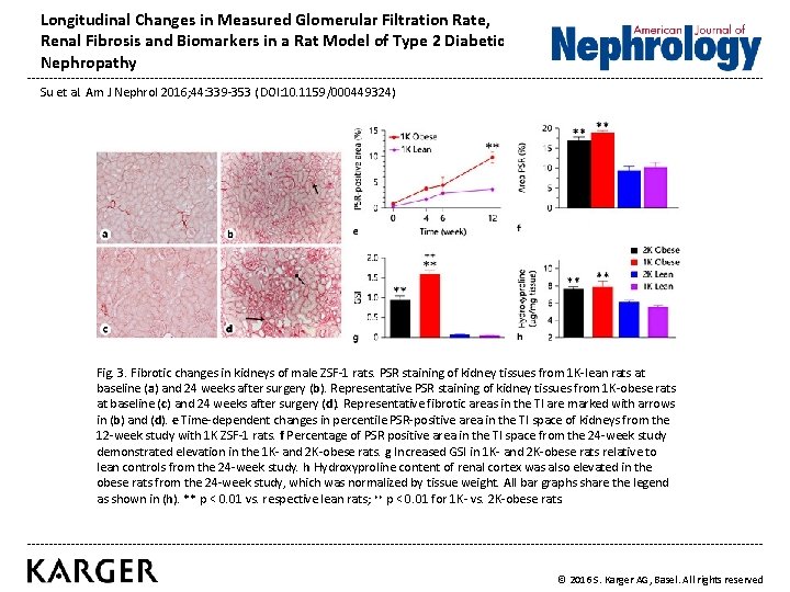 Longitudinal Changes in Measured Glomerular Filtration Rate, Renal Fibrosis and Biomarkers in a Rat