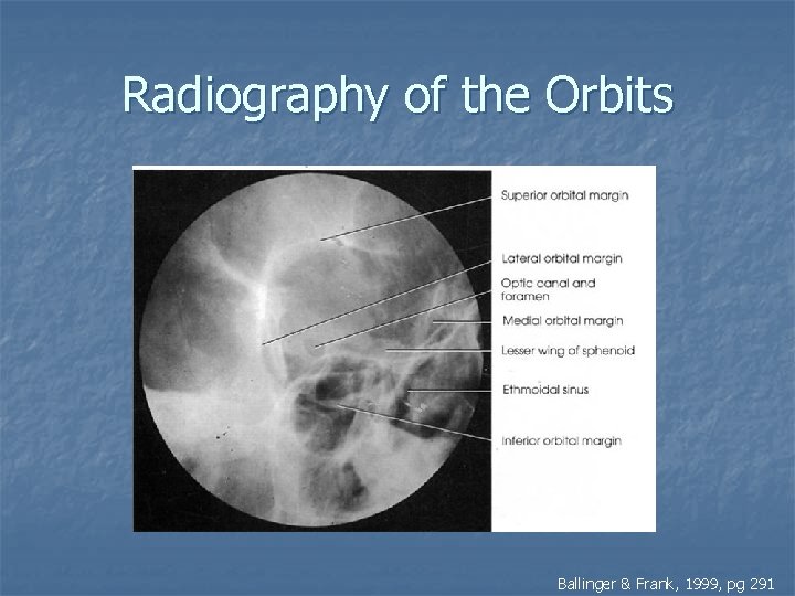 Radiography of the Orbits Ballinger & Frank, 1999, pg 291 