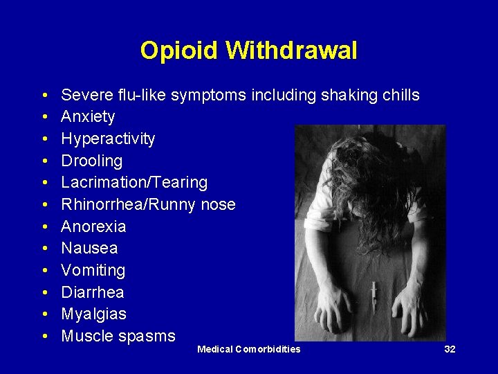 Opioid Withdrawal • • • Severe flu-like symptoms including shaking chills Anxiety Hyperactivity Drooling
