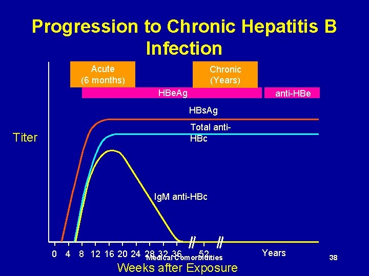 Progression to Chronic Hepatitis B Infection Acute (6 months) Chronic (Years) HBe. Ag anti-HBe