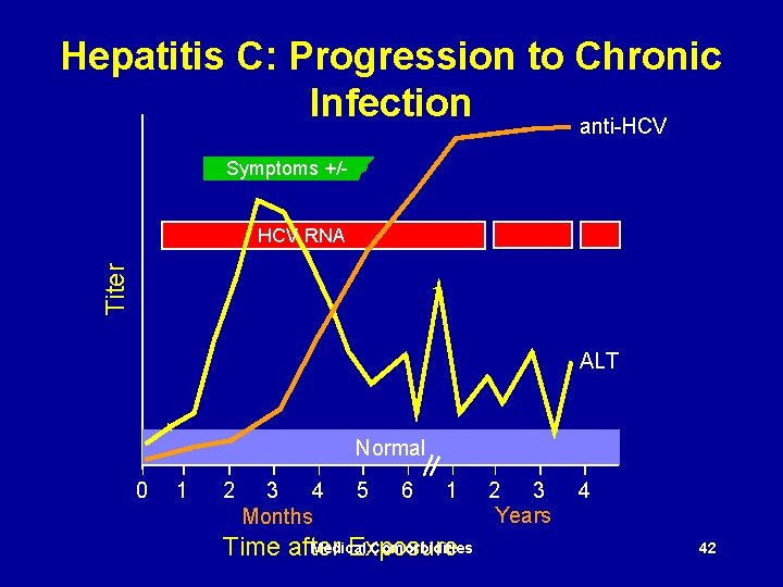 Hepatitis C: Progression to Chronic Infection anti-HCV Symptoms +/- Titer HCV RNA ALT Normal