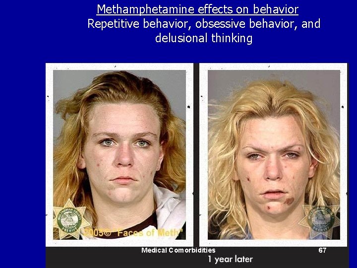 Methamphetamine effects on behavior Repetitive behavior, obsessive behavior, and delusional thinking Medical Comorbidities 67