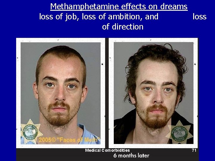 Methamphetamine effects on dreams loss of job, loss of ambition, and loss of direction