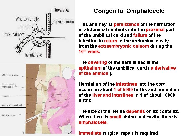 Congenital Omphalocele This anomayl is persistence of the herniation of abdominal contents into the