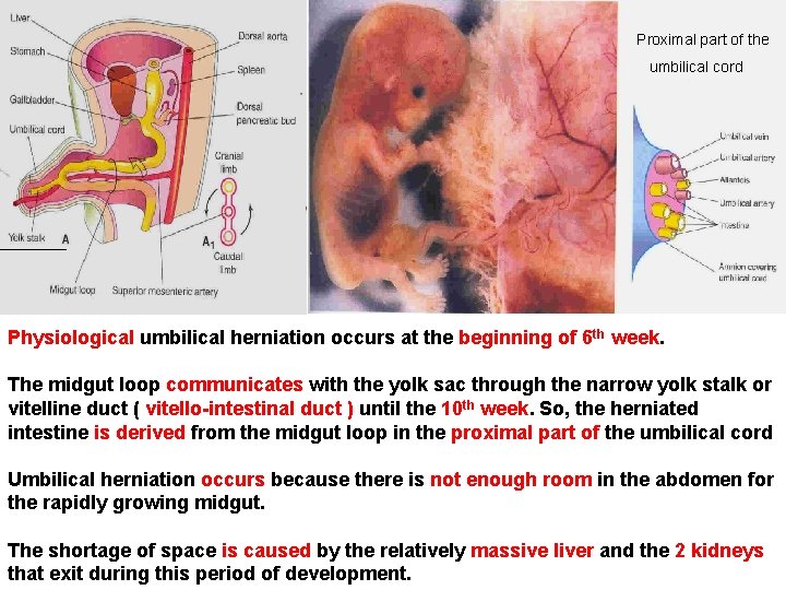 Proximal part of the umbilical cord Physiological umbilical herniation occurs at the beginning of