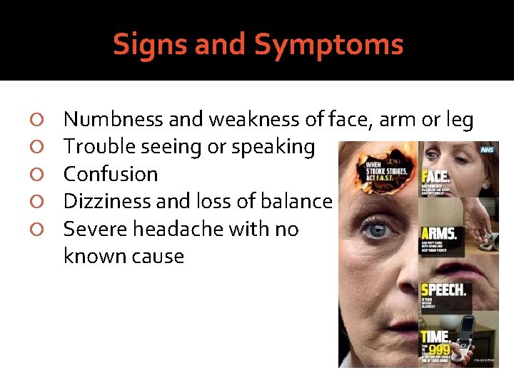 Signs and Symptoms Numbness and weakness of face, arm or leg Trouble seeing or