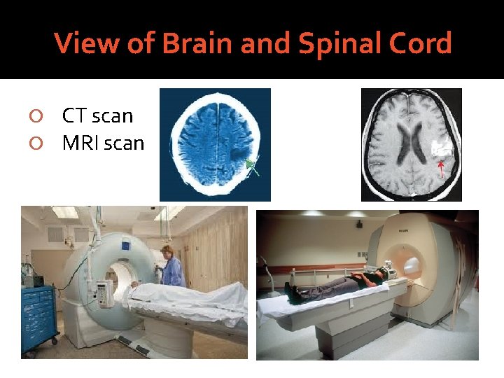 View of Brain and Spinal Cord CT scan MRI scan 