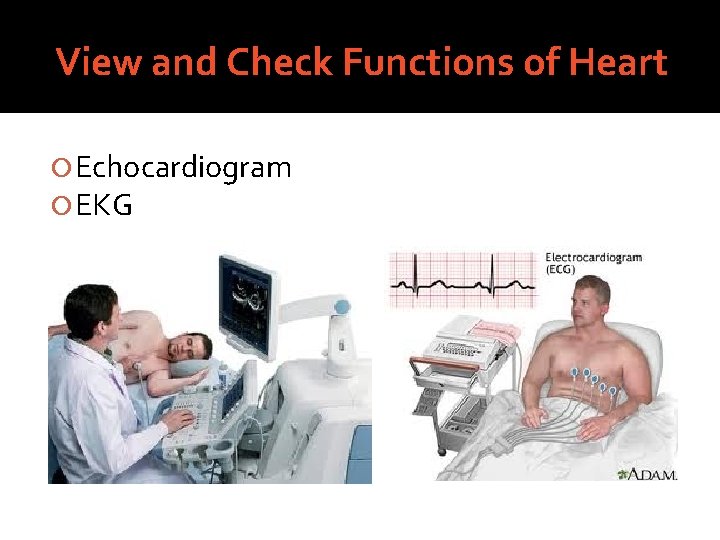 View and Check Functions of Heart Echocardiogram EKG 