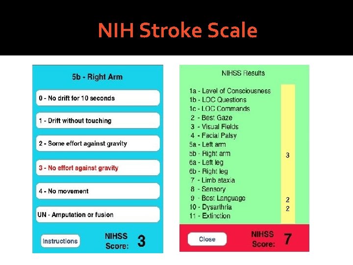 NIH Stroke Scale 