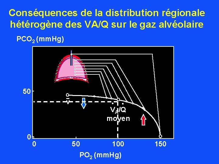 Conséquences de la distribution régionale hétérogène des VA/Q sur le gaz alvéolaire PCO 2