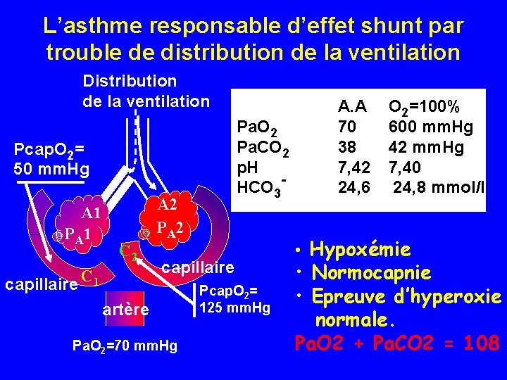 L’asthme responsable d’effet shunt par trouble de distribution de la ventilation Distribution de la