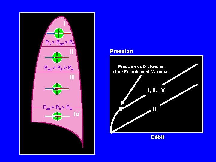 I PA > Part > Pv II Pression Part > PA > Pv III