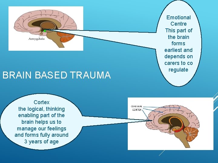 BRAIN BASED TRAUMA Cortex the logical, thinking enabling part of the brain helps us