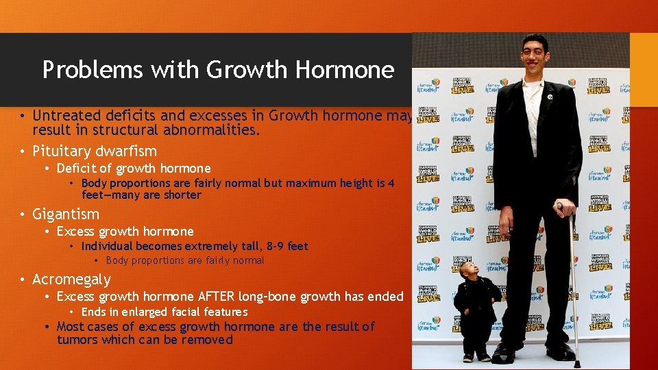 Problems with Growth Hormone • Untreated deficits and excesses in Growth hormone may result