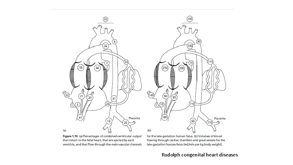 Rudolph congenital heart diseases 