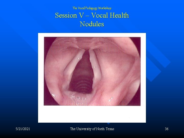 The Vocal Pedagogy Workshop Session V – Vocal Health Nodules 5/21/2021 The University of