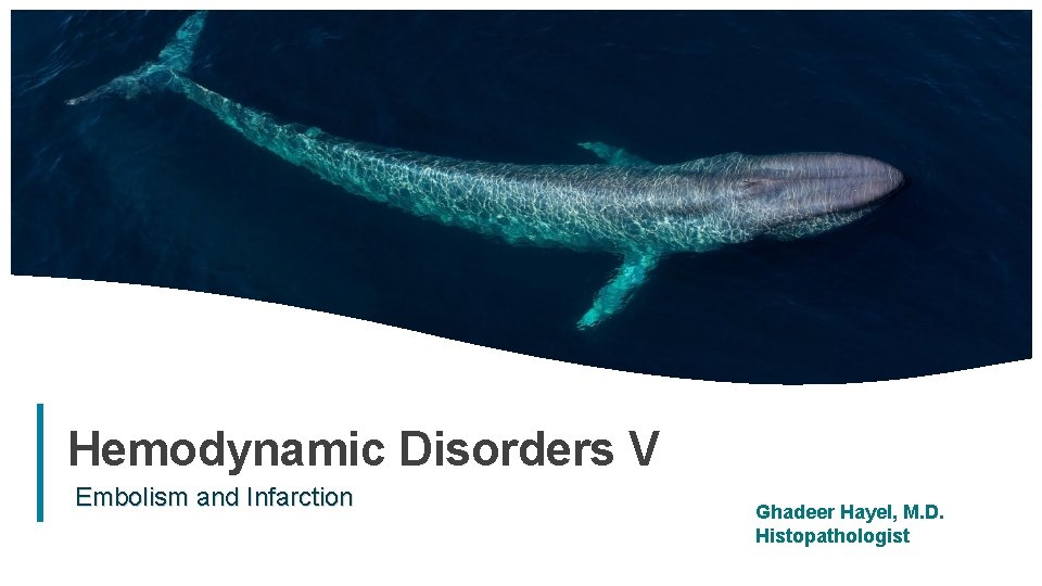 Hemodynamic Disorders V Embolism and Infarction Ghadeer Hayel, M. D. Histopathologist 1 