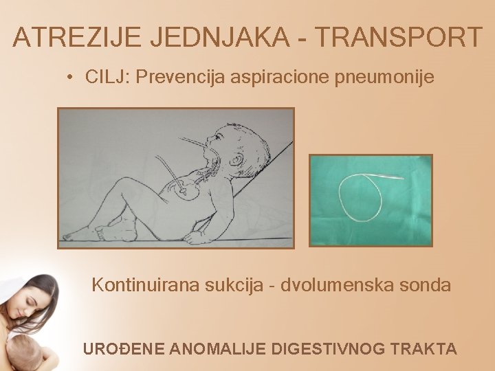 ATREZIJE JEDNJAKA - TRANSPORT • CILJ: Prevencija aspiracione pneumonije Kontinuirana sukcija - dvolumenska sonda