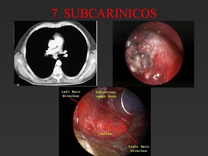 7. SUBCARINICOS 7. SUBCARINICOS