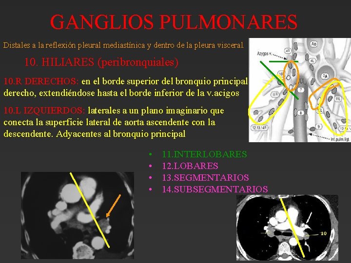 GANGLIOS PULMONARES Distales a la reflexión pleural mediastínica y dentro de la pleura visceral. GANGLIOS PULMONARES Distales a la reflexión pleural mediastínica y dentro de la pleura visceral.