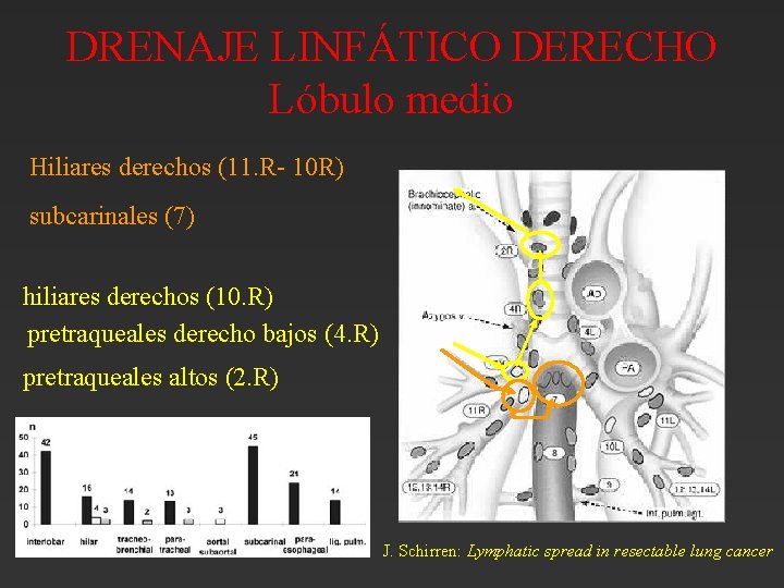 DRENAJE LINFÁTICO DERECHO Lóbulo medio Hiliares derechos (11. R- 10 R) subcarinales (7) hiliares DRENAJE LINFÁTICO DERECHO Lóbulo medio Hiliares derechos (11. R- 10 R) subcarinales (7) hiliares
