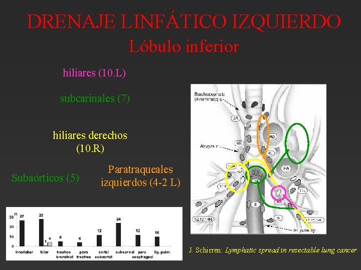 DRENAJE LINFÁTICO IZQUIERDO Lóbulo inferior hiliares (10. L) subcarinales (7) hiliares derechos (10. R) DRENAJE LINFÁTICO IZQUIERDO Lóbulo inferior hiliares (10. L) subcarinales (7) hiliares derechos (10. R)