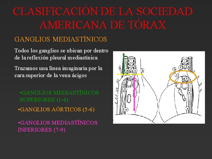CLASIFICACIÓN DE LA SOCIEDAD AMERICANA DE TÓRAX GANGLIOS MEDIASTÍNICOS Todos los ganglios se ubican CLASIFICACIÓN DE LA SOCIEDAD AMERICANA DE TÓRAX GANGLIOS MEDIASTÍNICOS Todos los ganglios se ubican