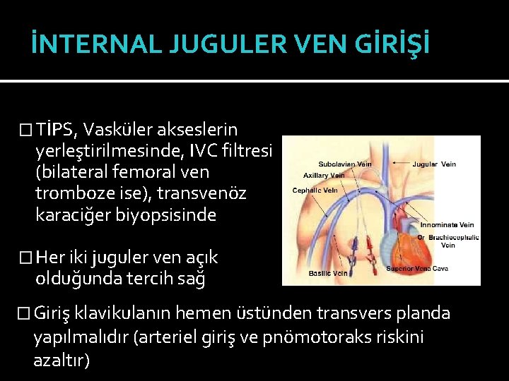 İNTERNAL JUGULER VEN GİRİŞİ � TİPS, Vasküler akseslerin yerleştirilmesinde, IVC filtresi (bilateral femoral ven