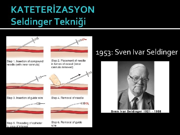 KATETERİZASYON Seldinger Tekniği 1953: Sven Ivar Seldinger 