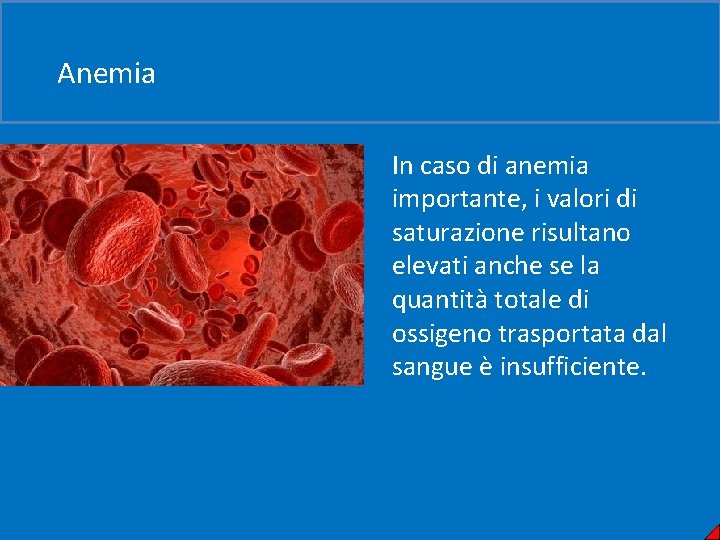 Anemia In caso di anemia importante, i valori di saturazione risultano elevati anche se