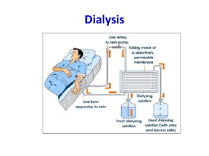 Dialysis 