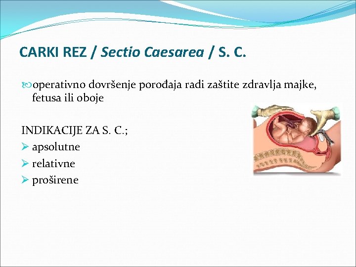 CARKI REZ / Sectio Caesarea / S. C. operativno dovršenje porođaja radi zaštite zdravlja