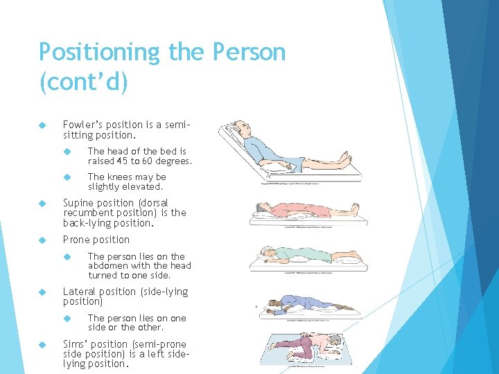 Positioning the Person (cont’d) Fowler’s position is a semisitting position. The head of the