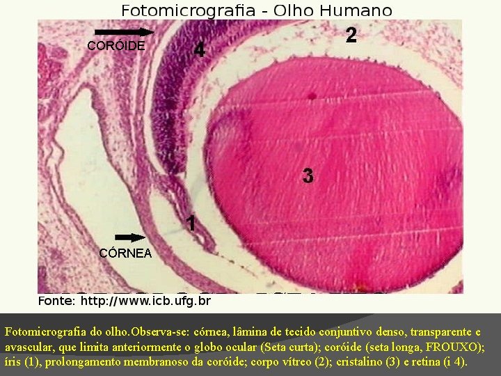 CORÓIDE CÓRNEA Fotomicrografia do olho. Observa-se: córnea, lâmina de tecido conjuntivo denso, transparente e