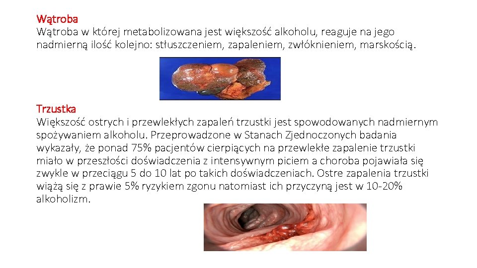 Wątroba w której metabolizowana jest większość alkoholu, reaguje na jego nadmierną ilość kolejno: stłuszczeniem,