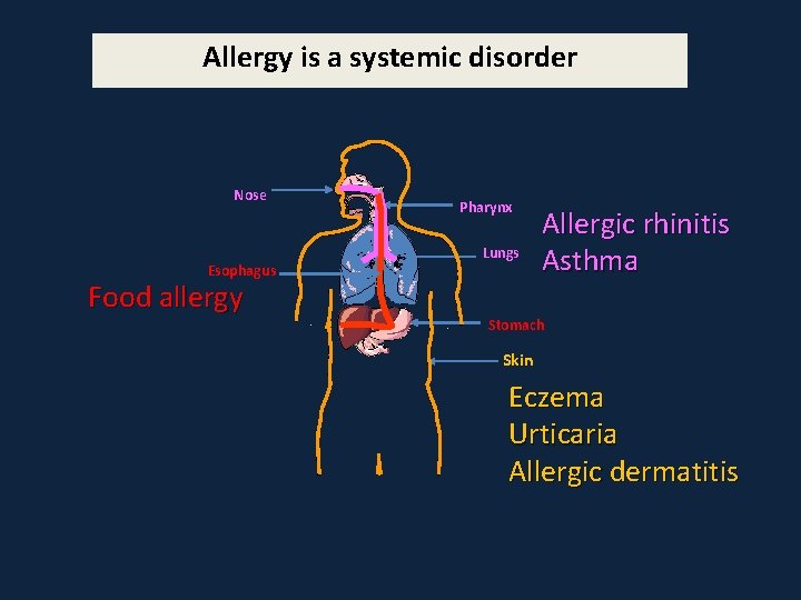 Allergy is a systemic disorder Nose Esophagus Food allergy Pharynx Lungs Allergic rhinitis Asthma