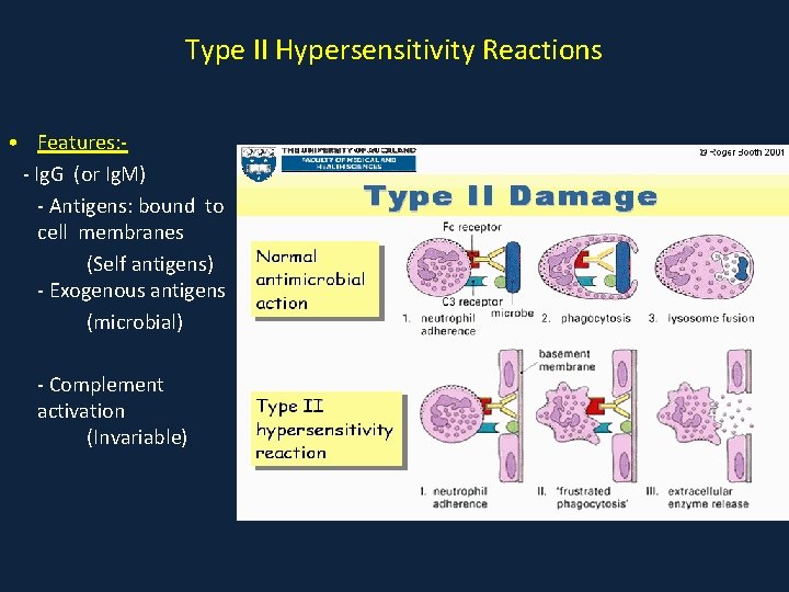 Type II Hypersensitivity Reactions • Features: - Ig. G (or Ig. M) - Antigens: