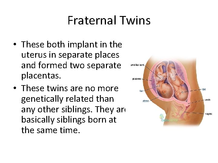 Fraternal Twins • These both implant in the uterus in separate places and formed Fraternal Twins • These both implant in the uterus in separate places and formed